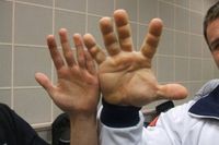 Inilah Denis Cyplenkov, Real Life Hulk Bertangan Raksasa