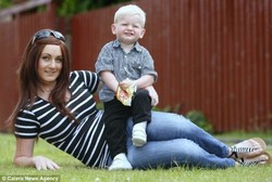 Wanita Ini Tak Sadar Ada Tumor Bersarang di Otaknya Selama 10 Tahun