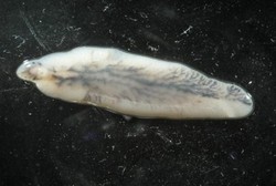 Tak Bisa Disepelekan, Ini Akibatnya Jika Seseorang Kena Cacingan