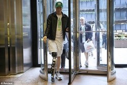 Bukan Telepati, Kini Kaki Buatan Bisa Dikendalikan Lewat Pikiran