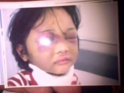 Cucu Dianiaya Ibu Kandung, Nenek Lapor Polisi