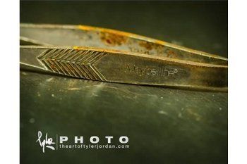 Benda Tergila yang Nyasar ke Uretra, Silet hingga Peniti Berkarat