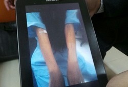 Novi Masih Dirawat di RSKO Cibubur, Sidang Ditunda Pekan Depan