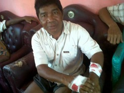 Syahrani Duel Melawan Buaya, Kedua Tangannya Terluka