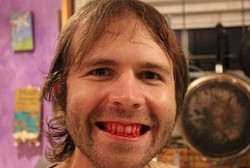 Kena Penyakit Misterius, Pria Ini Hanya Bisa Makan Daging Mentah