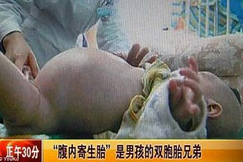 Xiao Feng, Balita Laki-laki yang Hamil Saudara Kembarnya Sendiri