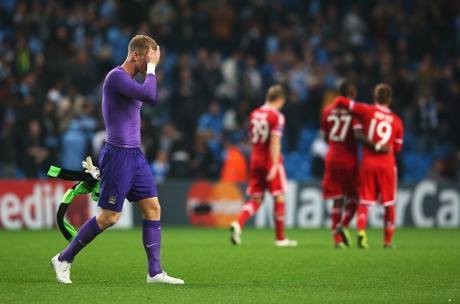 Joe Hart Juga Dikritik Pelatih Inggris