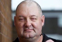 Tim Medis Kembalikan Penglihatan Pria Ini dengan Manfaatkan Giginya