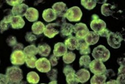 Kasus Orang-orang yang Otaknya Dimakan Amoeba Usai Bermain di Air