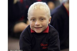 Kena Penyakit Langka, Bocah Ini Bisa Mati Karena Lecet atau Stres