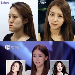 Bagian Tubuh yang Paling Sering Dipermak oleh Artis KPop