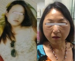 Duh, Wanita Muda Ini Malah Mirip Nenek-nenek Pasca Operasi Plastik