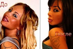 Baru Umur 25 Tahun, Alyona Sudah 13 Kali Operasi Plastik