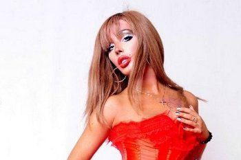 Begini Rupa Alyona Piskun, Wanita 25 Tahun yang 13 Kali Operasi Plastik