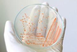 Lutut Luka Akibat Jatuh, Murid SMP Ini Terinfeksi Bakteri Pemakan Daging