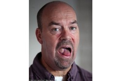 Lidahnya Tak Biasa, Pendesain Bungkus Rokok Ini Ternyata Kena Kanker Lidah