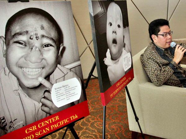 Bantuan Untuk Anak Indonesia Tersenyum