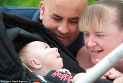 Sakit Langka, Bocah Ini Harus Dicium 5 Kali Sehari agar Bisa Napas Lagi