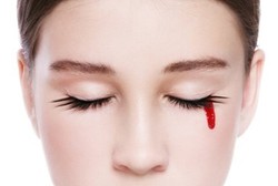 Aneh Tapi Nyata, 6 Orang Berpenyakit Misterius yang Bisa Menangis Darah