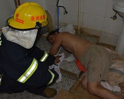 Selamatkan Cincin Pernikahan, Tangan Pria Ini Malah Tersangkut di Lubang Toilet