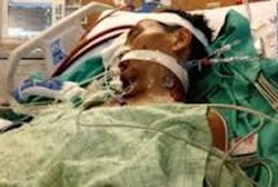 Mulanya Kena Flu, Pelari Maraton Ini Tidak Bernapas Selama Sebulan