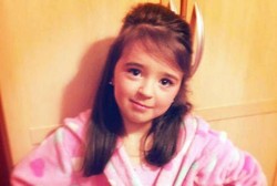 Sedang Asyik Bermain, Wajah Bocah 8 Tahun Ini Diserang 2 Anjing Bulldog