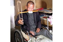 Tak Punya Uang Berobat ke RS, Pria Ini Amputasi Kakinya dengan Pisau Buah