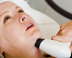 Perawatan untuk Menghilangkan Double Chin dengan Teknik Vakum 