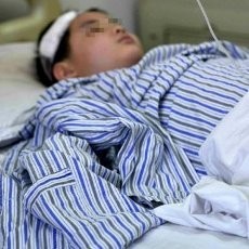 Ibu Bertengkar dengan Kekasihnya, Tangan Bocah China Dipotong