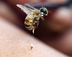 Terapi Sengat Lebah, Perawatan Kecantikan yang Diklaim Bisa Atasi Jerawat