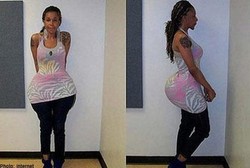 Suntik Bokong Pasien dengan Semen dan Lem, Dokter Palsu Ini Dibui Satu Tahun