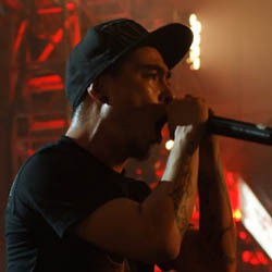 Disiram Air Keras, Barry Saint Loco Menderita Luka Bakar di Wajah