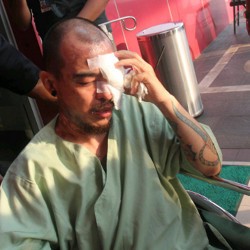 Disiram Air Keras, Mata Barry Saint Loco Sulit Melihat