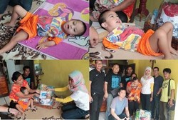 2 Tahun Usai Operasi Bibir Sumbing, Kini Dede Tegar Bisa Tersenyum Manis