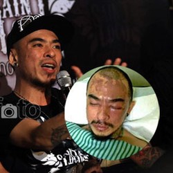 Penyiraman Barry Saint Loco, Polisi: Cairan yang Digunakan Adalah Soda Api