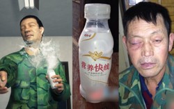 Pria Ini Terancam Buta Akibat Ledakan Botol Yogurt yang Diminumnya