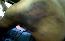 Penganiayaan di Bandungan Dipastikan Dilakukan Oleh 3 Oknum Polisi