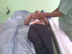 Diduga Depresi Soal Keluarga, Sunarto Gantung Diri di Pohon Akasia