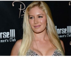 Terlalu Besar, Heidi Montag Kecilkan Payudara dari Ukuran F Jadi D