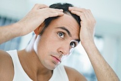 Pria Dewasa Cepat Botak? Riset: Salahkan Gravitasi