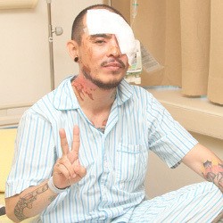 Barry Saint Loco Tak Dendam dengan Sang Penyiram Air Keras