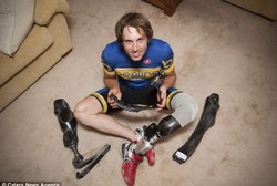 Diamputasi, Pria Ini Punya 12 Kaki Prostetik agar Bisa Olahraga Ekstrem