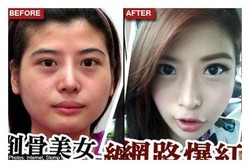 Gara-gara Dijuluki Wajah Pancake, Wanita Ini Pangkas Dagunya