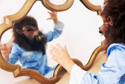 5 Manusia Serigala Sesungguhnya, Tubuh Penuh Bulu Akibat Sindrom Langka 5 Manusia Serigala Sesungguhnya, Tubuh Penuh Bulu Akibat Sindrom Langka