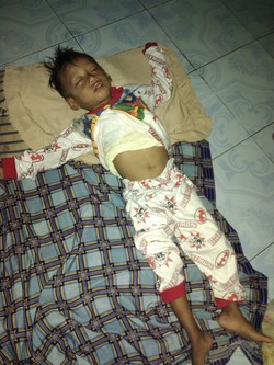 Tak Hanya Balita Iqbal, Ada Bocah Lainnya di Serang Terserang Gizi Buruk