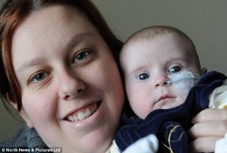 Kisah Sophie, Bayi yang Terlahir dengan Separuh Jantung