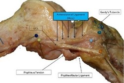 Peneliti dari Belgia Temukan Ligamen Baru Pada Lutut Manusia