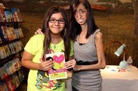  Lizzie Velasquez, Wanita Terkurus Sejagat yang Tubuhnya Tinggal Tulang