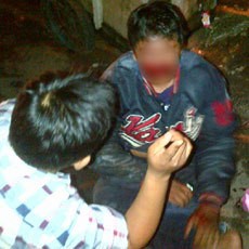 Jalan Berlubang di Warung Buncit, Pemotor Ini Terjatuh dan Luka Parah