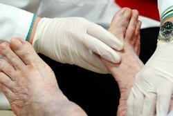 Luka yang Tidak Terasa Pada Pasien Diabetes dan Cara Perawatannya